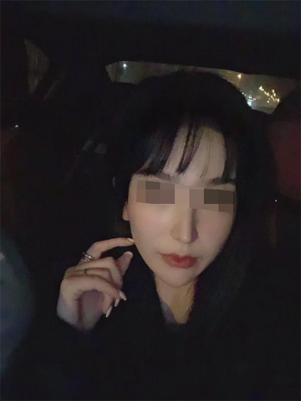 北京圣嘉荣黄大勇下颌角磨骨怎么样,价格案例