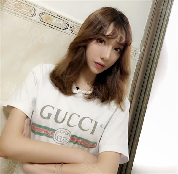 福州美贝尔赵栋材软骨隆鼻怎么样?价格案例