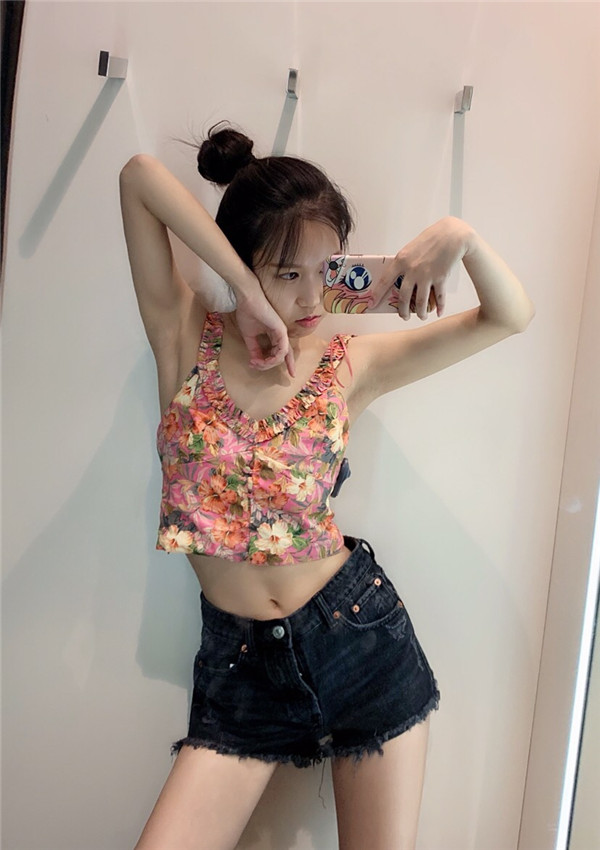 深圳容术王攀飞吸脂怎么样?价格案例