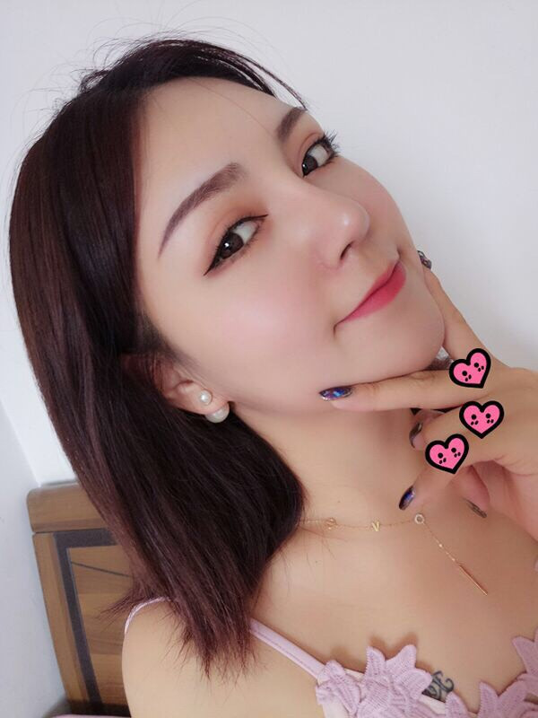 长春中妍美庞玖明垫下巴怎么样?价格案例
