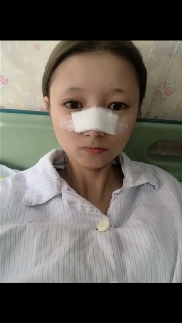 珠海科美刘彤隆鼻、注射瘦脸怎么样?价格案例