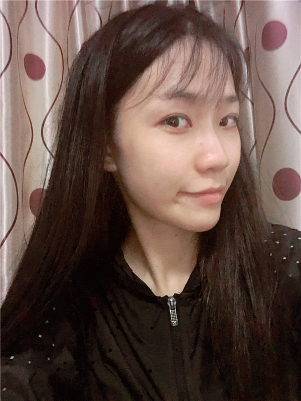 重庆铂生杜亚旭脂肪填充修复怎么样?价格案例