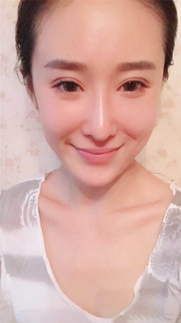 武汉美立方软骨隆鼻怎么样?价格案例