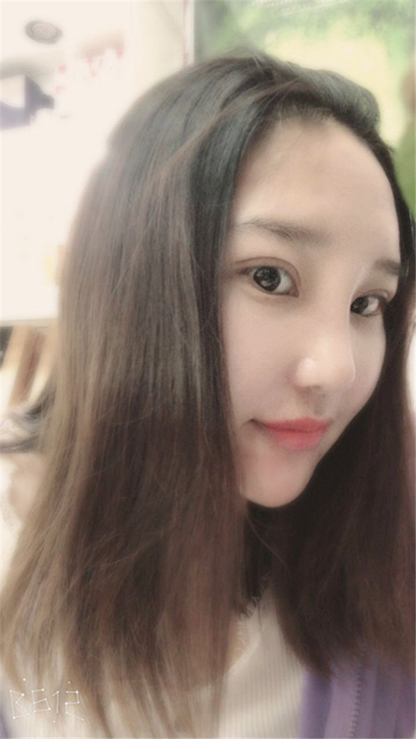 苏州美莱张亮鼻部手术怎么样?价格案例