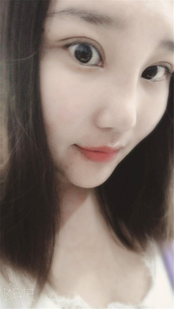 苏州美莱张亮鼻部手术怎么样?价格案例