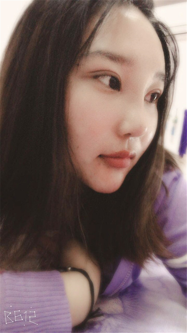 苏州美莱张亮鼻部手术怎么样?价格案例