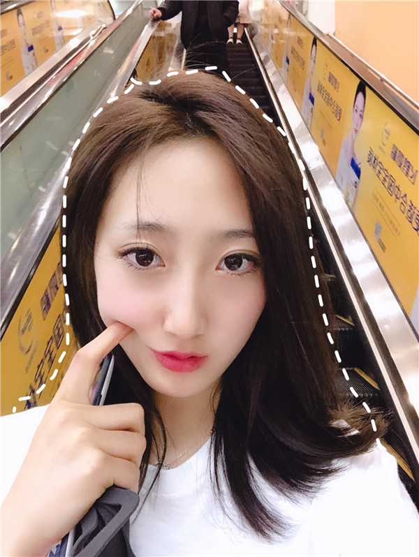 上海银城皮肤医疗热玛吉怎么样?价格案例