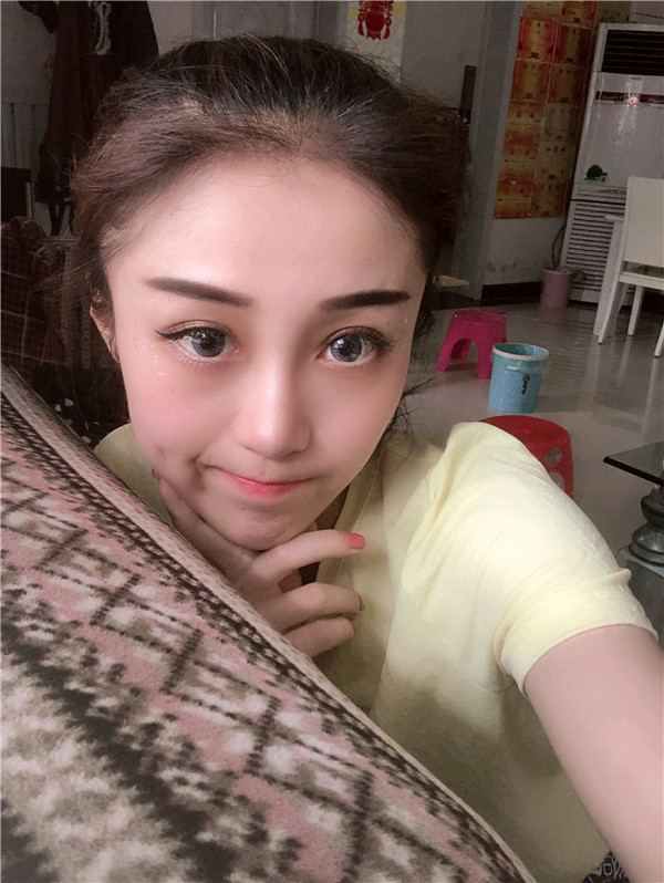 兰州亚韩李军梅软骨隆鼻怎么样?价格案例