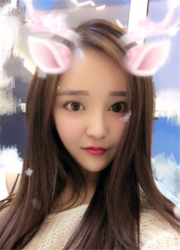 锦州斯美诺耿成虎全脸填充怎么样?价格案例