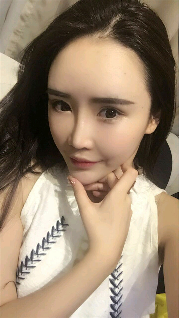 长春中妍脱毛怎么样?价格案例