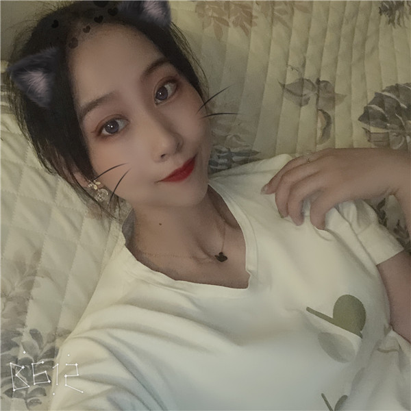 荆州华美史俊荣眼部综合怎么样?价格案例