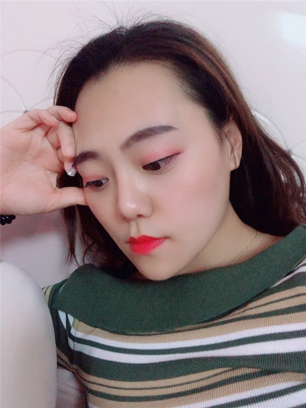 北京艾玛韦元强脂肪填充怎么样?价格案例