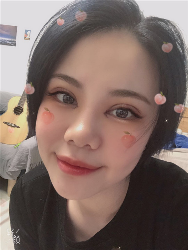 郑州丽天罗明生瘦脸怎么样?价格案例
