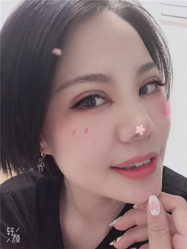 郑州丽天罗明生瘦脸怎么样?价格案例