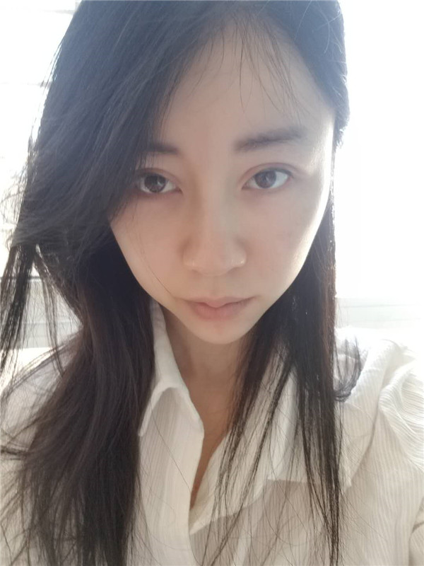 广州健丽王科学激光去眼袋怎么样?价格案例
