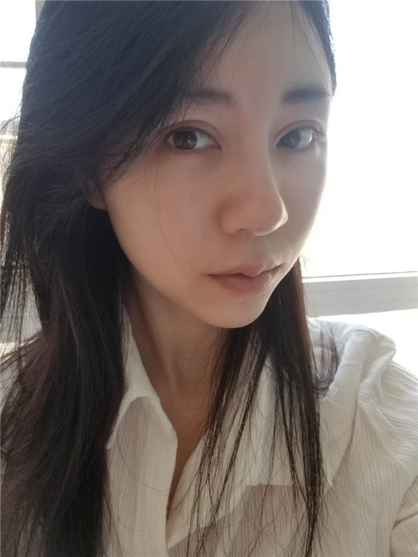 广州健丽王科学激光去眼袋怎么样?价格案例