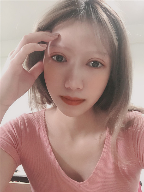 武汉希思特双眼皮怎么样?价格案例