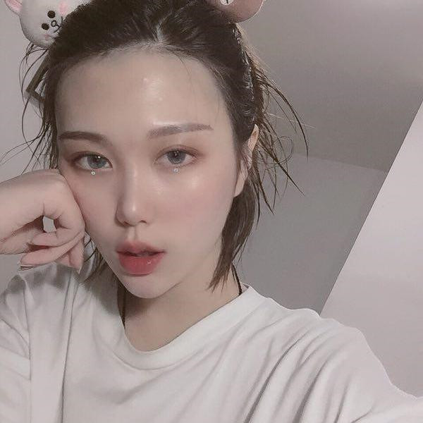 名人姜兆辉垫下巴怎么样?价格案例