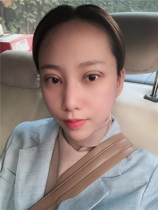 南京华韩奇致刘大猛眼部整形怎么样?价格案例