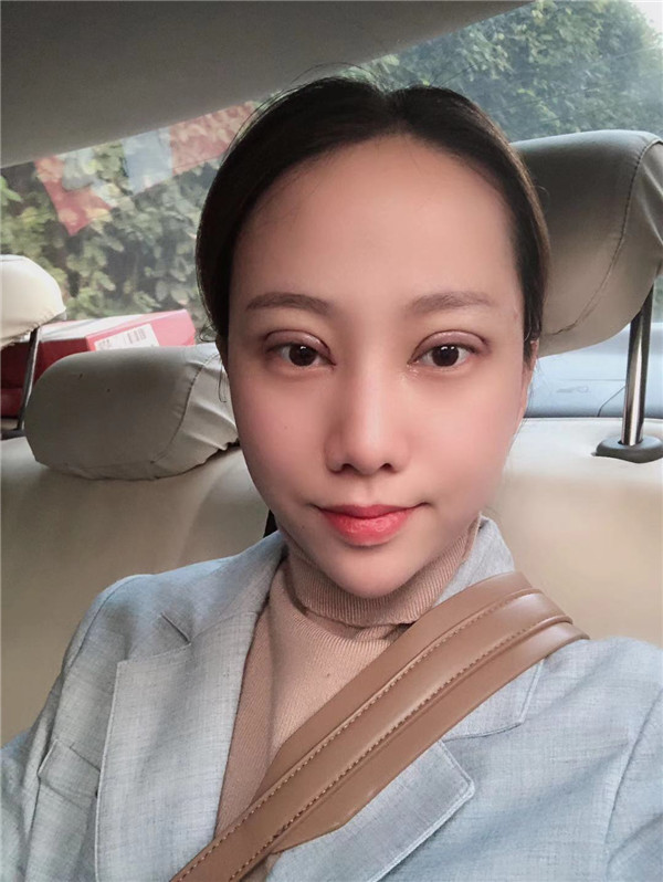 南京华韩奇致刘大猛眼部整形怎么样?价格案例
