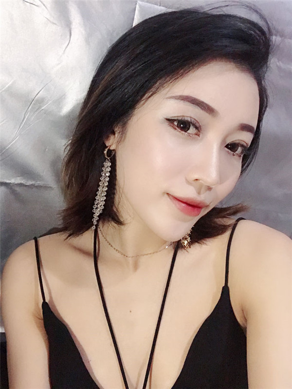 广州晨曦李宗磊脂肪填充怎么样?价格案例