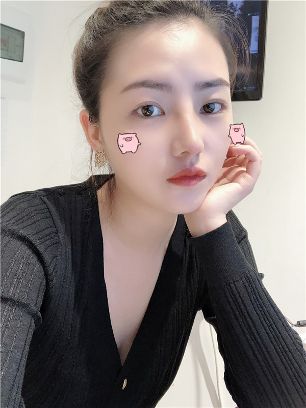 重庆华美李超鼻部手术怎么样?价格案例