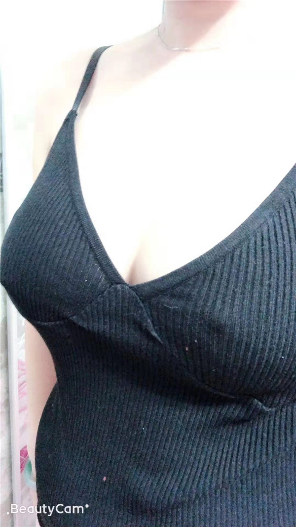 大直超龙吴显宇假体隆胸怎么样?价格案例