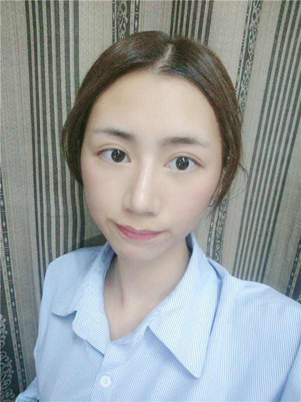 杭州整形医院唐冬生下颌磨骨怎么样?价格案例