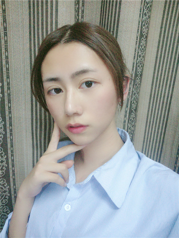 杭州整形医院唐冬生下颌磨骨怎么样?价格案例