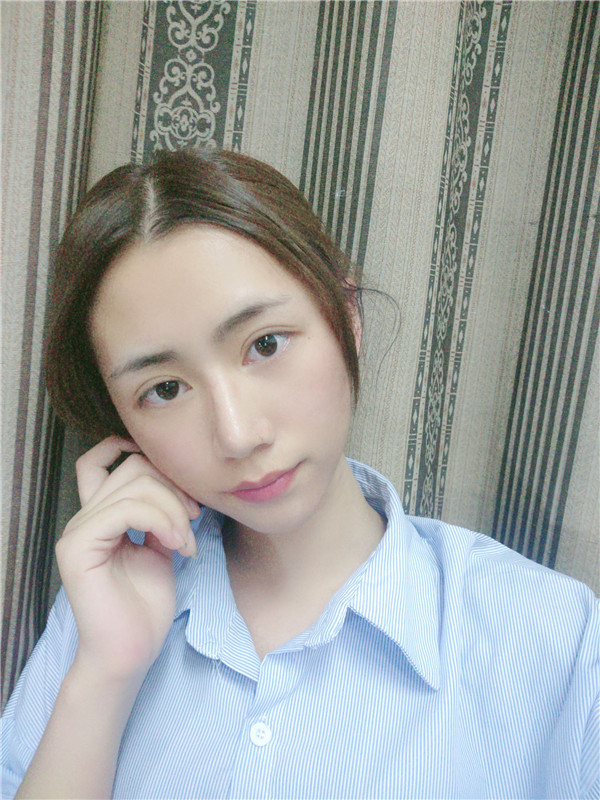 杭州整形医院唐冬生下颌磨骨怎么样?价格案例