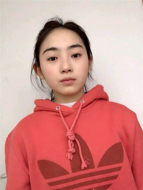 北京长虹于志宏隆鼻怎么样?价格案例
