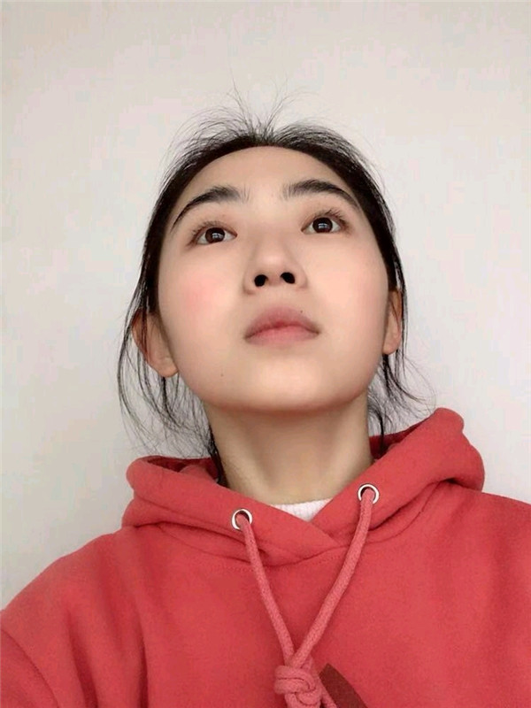 北京长虹于志宏隆鼻怎么样?价格案例