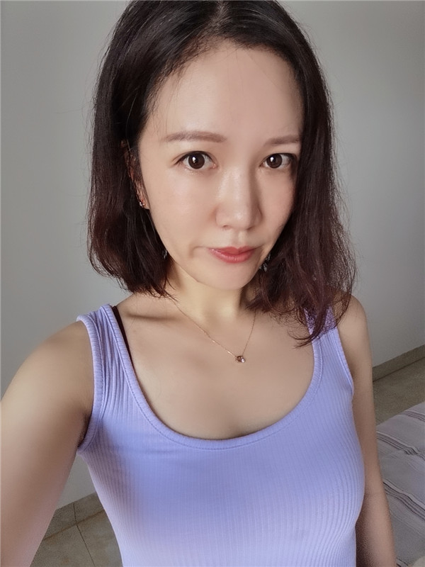 广州荔医整形尚俊植发怎么样?价格案例