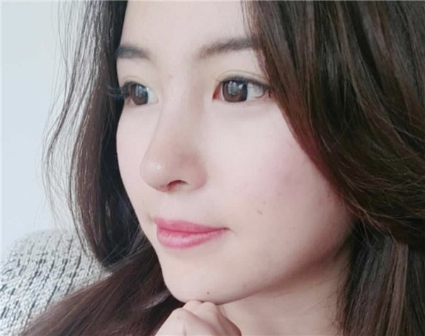 佛山医博士刘哲隆鼻怎么样?价格案例