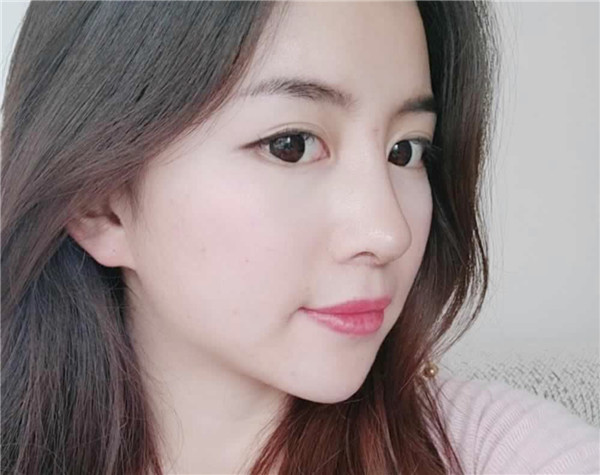 佛山医博士刘哲隆鼻怎么样?价格案例