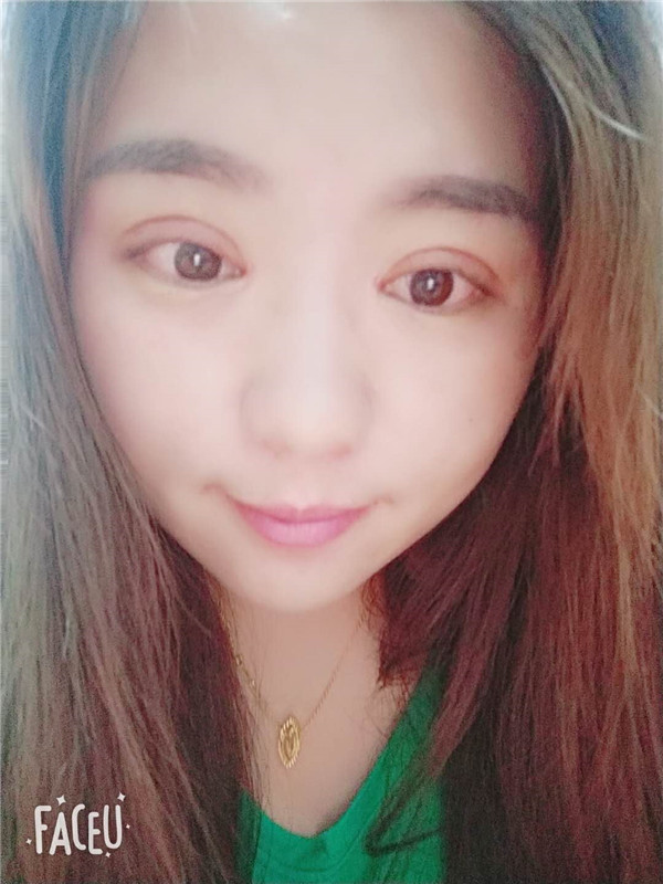 北京圣嘉新陈圣英双眼皮怎么样?价格案例
