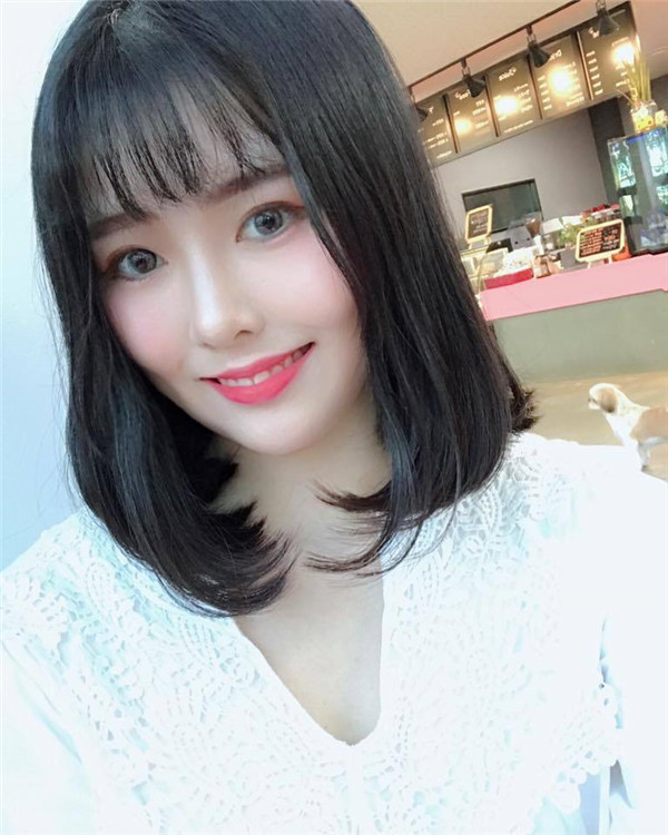 无锡苏亚吕钢脂肪填充怎么样?价格案例