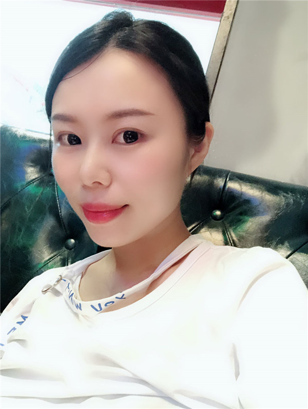 大直超龙王海刚双眼皮怎么样?价格案例