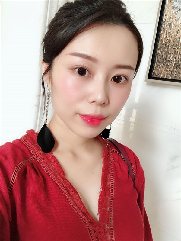 大直超龙王海刚双眼皮怎么样?价格案例