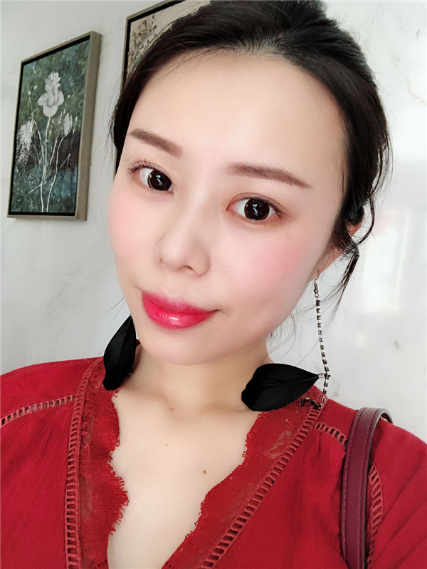 大直超龙王海刚双眼皮怎么样?价格案例