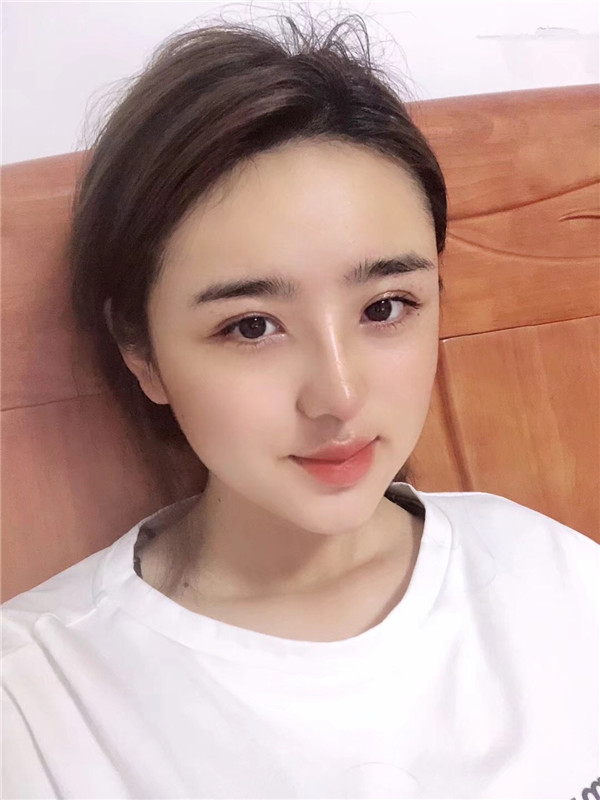 厦门安黛美林清福脂肪填充怎么样?价格案例