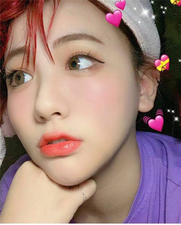 南通伊莱美张兢吸脂怎么样?价格案例