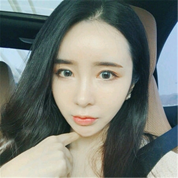 南京美贝尔张永升做鼻子怎么样?价格案例