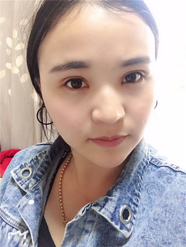云南华美美莱李韬眼部综合怎么样?价格案例