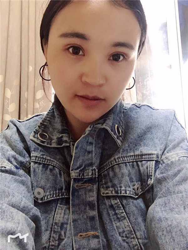 云南华美美莱李韬眼部综合怎么样?价格案例