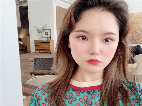 重庆美莱郑楠隆鼻怎么样?价格案例