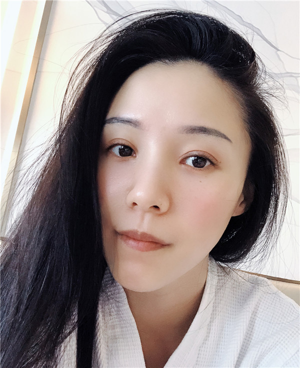 杭州艺星杨连华眼部整形怎么样?价格案例