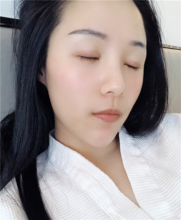 杭州艺星杨连华眼部整形怎么样?价格案例