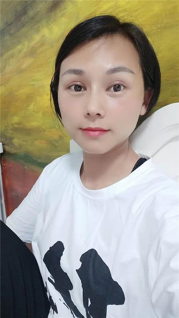 深圳军科刘月更鼻部手术怎么样?价格案例