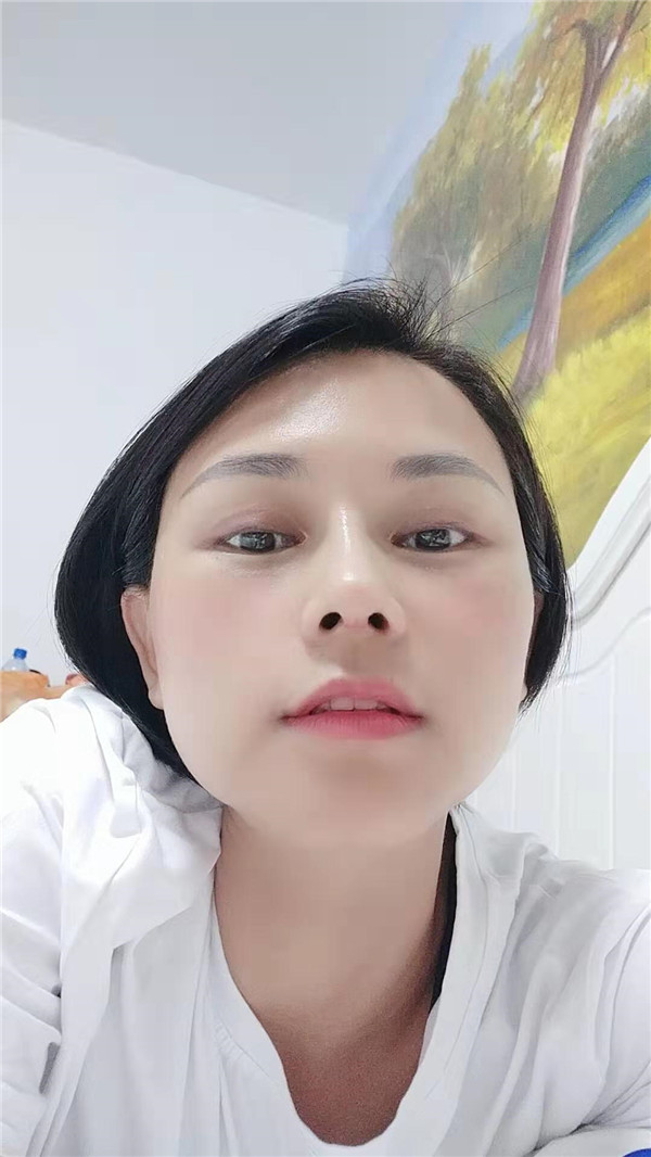 深圳军科刘月更鼻部手术怎么样?价格案例